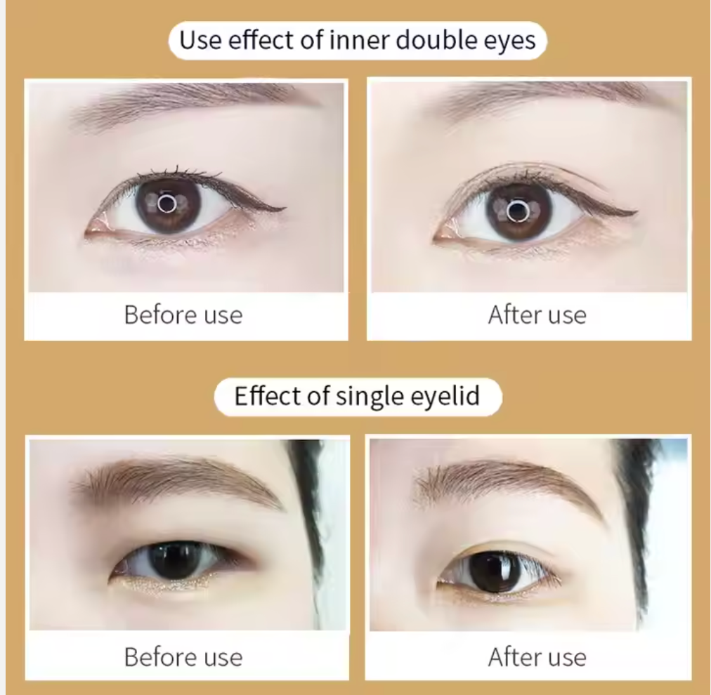 MAR'F 300 Pairs Instant Eyelid Lift Without Surgery